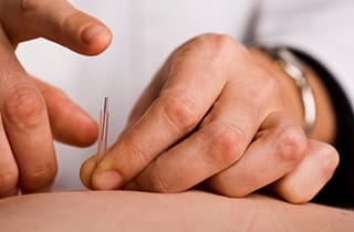 Acupuncture addiction treatment is introduced in Singapore